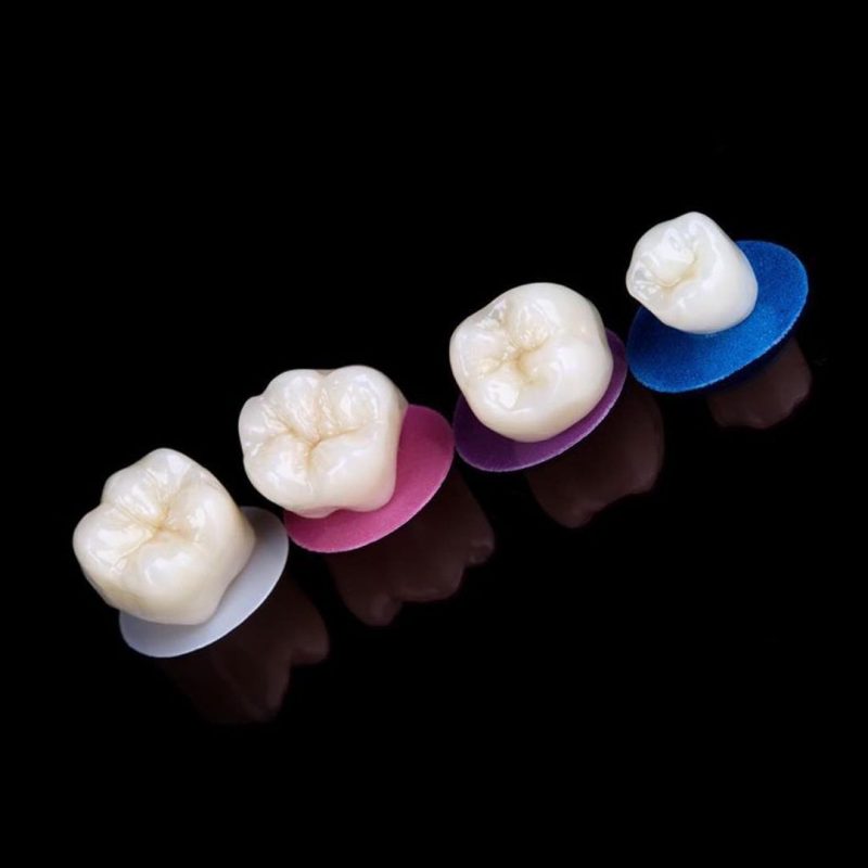 Prothèse dentaire fixe : couronne dentaire au Cabinet dentaire MC dental concept à Cheraga, Alger en Algérie